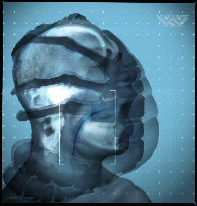 Facehugged X-Ray (Lorin Wood)