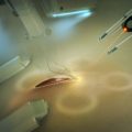 Medpod surgery (laser scalpel) (David Levy)