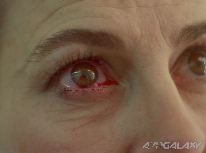 Contact Lens tests for Ripley
